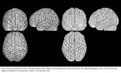 Brain anatomy to identify an individual like finger printing!