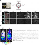 A reliable, easy-to-use mouse model for investigating bone metastasis