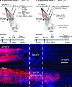 Regrowing and rewiring the spinal cord after injury!