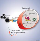 Prognostic biomarker found in ovarian cancer patients 