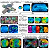 4D microscope to watch embryonic development