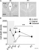 Neuronal death in cesarean-born mice during early brain development