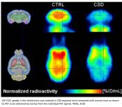Hyperglycemia from chronic stress may cause spatial memory impairment!