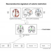 Weight loss success linked with active self-control regions of the brain