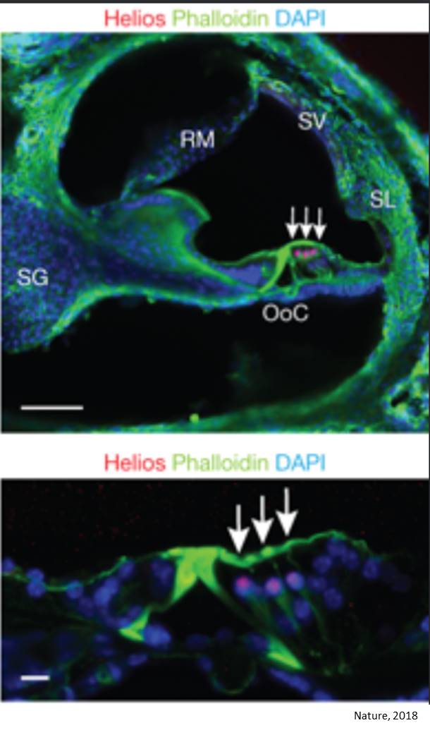 Helios, a key transcriptional regulator implicated in age-related hearing loss 