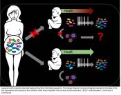 Altered microbiome after caesarean section impacts baby&#039;s immune system