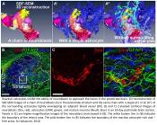 Astrocytes block neuronal migration after stroke