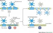 Different types of oligodendrocytes in people with MS