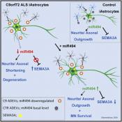 Extracellular vesicle delivered microRNAs play a critical role in ALS