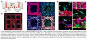 Human stem cell derived vascular grafts increase blood flow in infarcted rat hearts