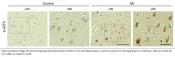 Reducing mRNA translation factor alleviates pathophysiology in Alzheimer&#039;s disease model mice