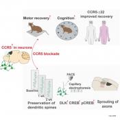 Patients lacking CCR5 recover better from mild stroke!