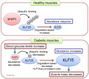 How diabetes causes muscle loss