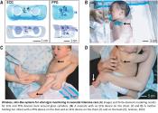 A wireless and battery-free neonatal vital signs monitoring system