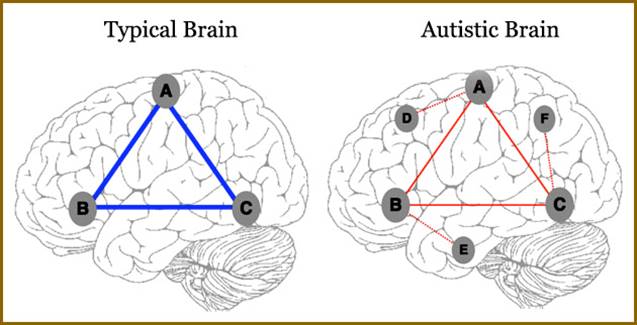 Can brain connectivity be as a biomarker in autism?
