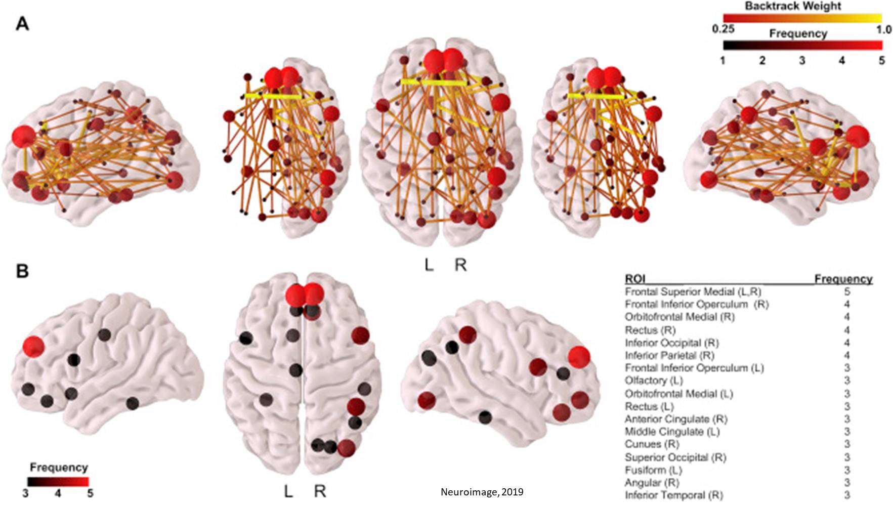 Predicting cognitive development at age 2 using AI and MRI