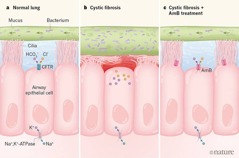 An antifungal non-selective channel drug shows promise for treating cystic fibrosis