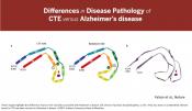 CTE differs from Alzheimer&#039;s disease in protein folding