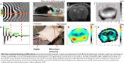 Magnetic resonance elastography (MRE) to measure the brain activity in milliseconds 
