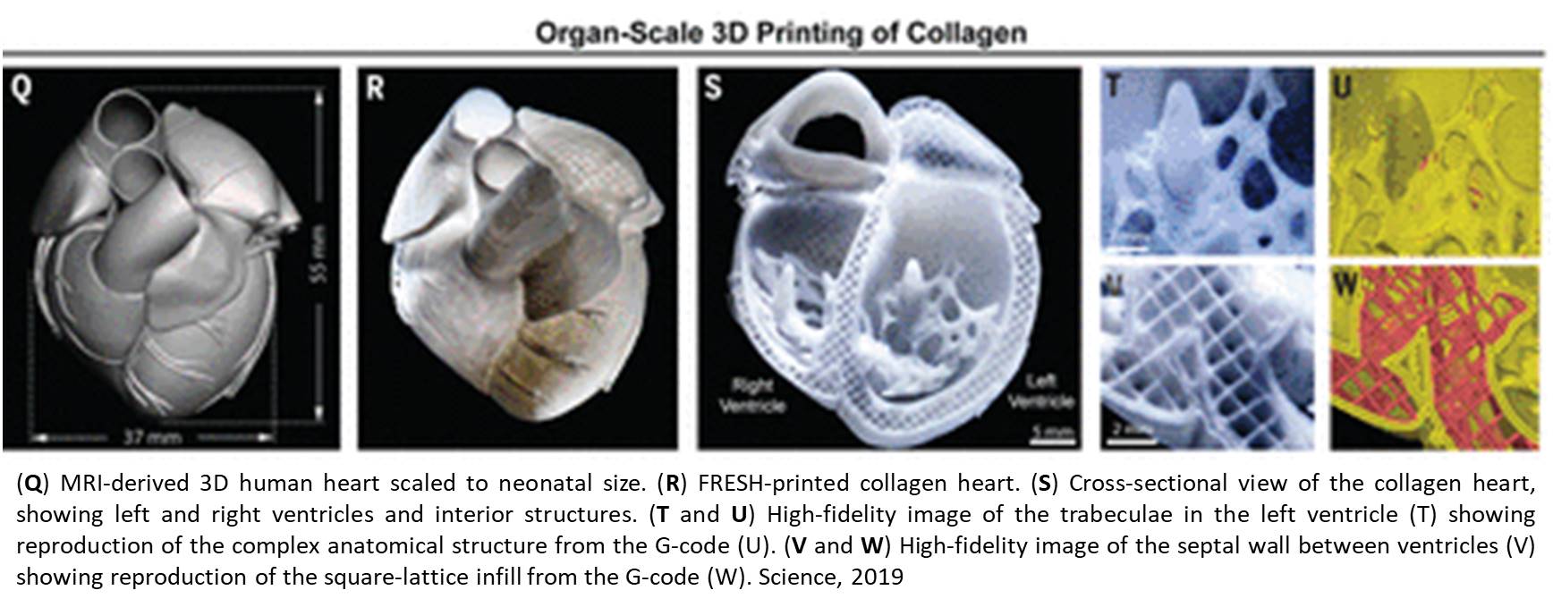3D printing of human heart components using collagen