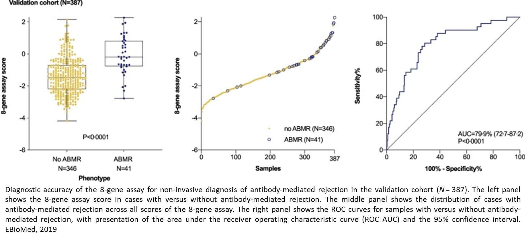 New blood mRNA assay to detect rejection by antibodies after kidney transplant