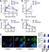 Sex-specific gene exacerbates Parkinson&#039;s disease in male mice