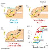 Neurons involved in touch-evoked pain after nerve injury identified