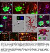 Absence of microglia prevents plaque formation!
