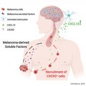Astrocyte immune response plays a key role in brain metastasis from melanoma