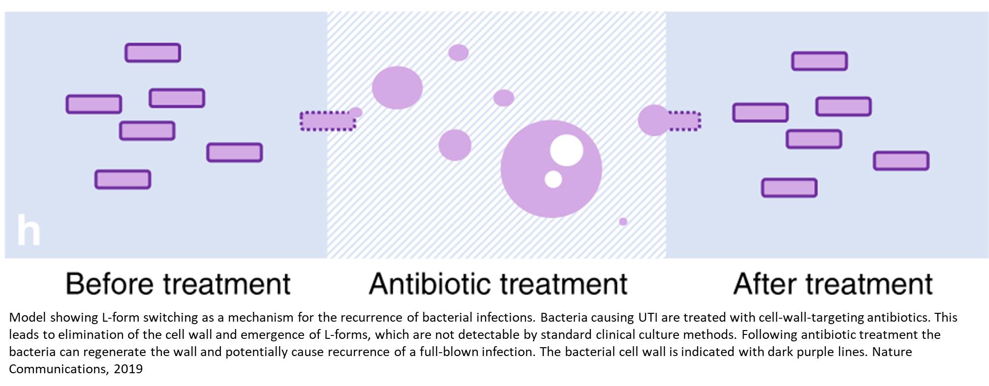 Bacteria shed the membrane to survive antibiotic treatment