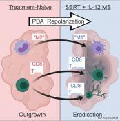 Radiation and IL-12 combination therapy to treat pancreatic cancer &nbsp;