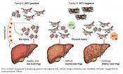 A protein controlling liver scarring identified!