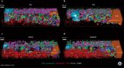 Improved diagnosis of non-alcoholic fatty liver disease with 3D model of human liver