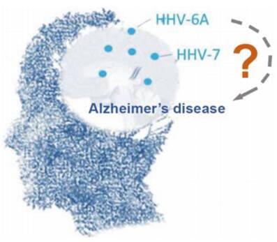Virus infections may not be linked to Alzheimer&#039;s disease