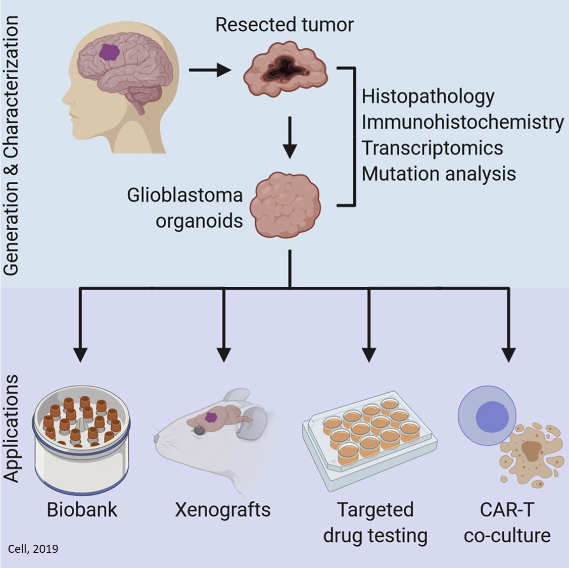 Brain tumor organoids may be key to time-sensitive treatments for glioblastomas