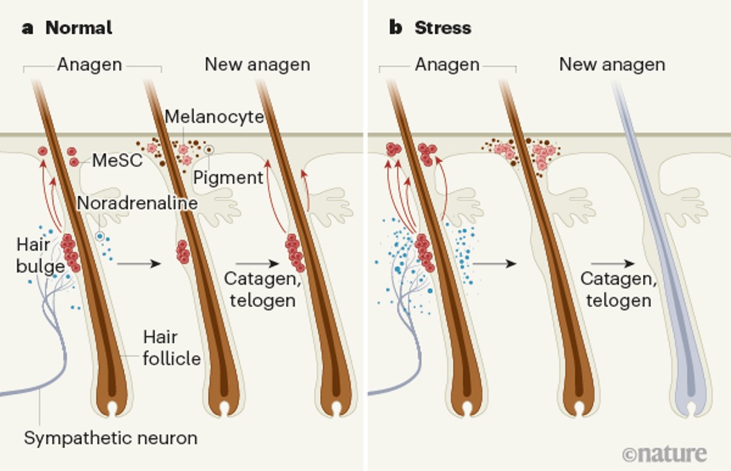 How acute stress turns hair white