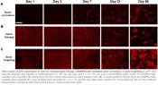 CRISPR &#039;minigene&#039; approach stops genetic liver disease in mice