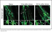 How stress remodels the brain