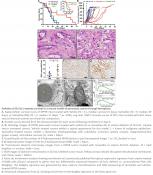 Cysteine deprivation kills pancreatic tumor cells by ferroptosis