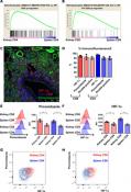 Hypoxia mediated kidney damage in lupus
