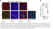 Heart cell proliferation by an oncogene, Myc 
