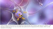 Auto-immune reaction between T cells and alpha-synuclein detected early in Parkinson&#039;s patients