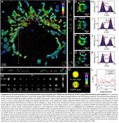 Nanoscopy to visualize minute structures inside whole cells