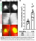 Focused ultrasound opening of BBB to deliver drugs into the brain