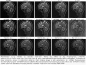 AI techniques are highly unstable in medical imaging