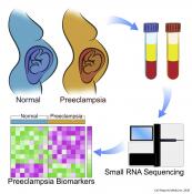 MocroRNA to predict the risk of premature birth