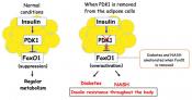 The mechanism of development of diabetes and fatty liver 
