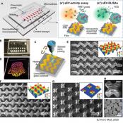 Nanopatterned &#039;lab-on-a-chip&#039; noninvasively detects early and advanced breast cancer from extracellular vesicles