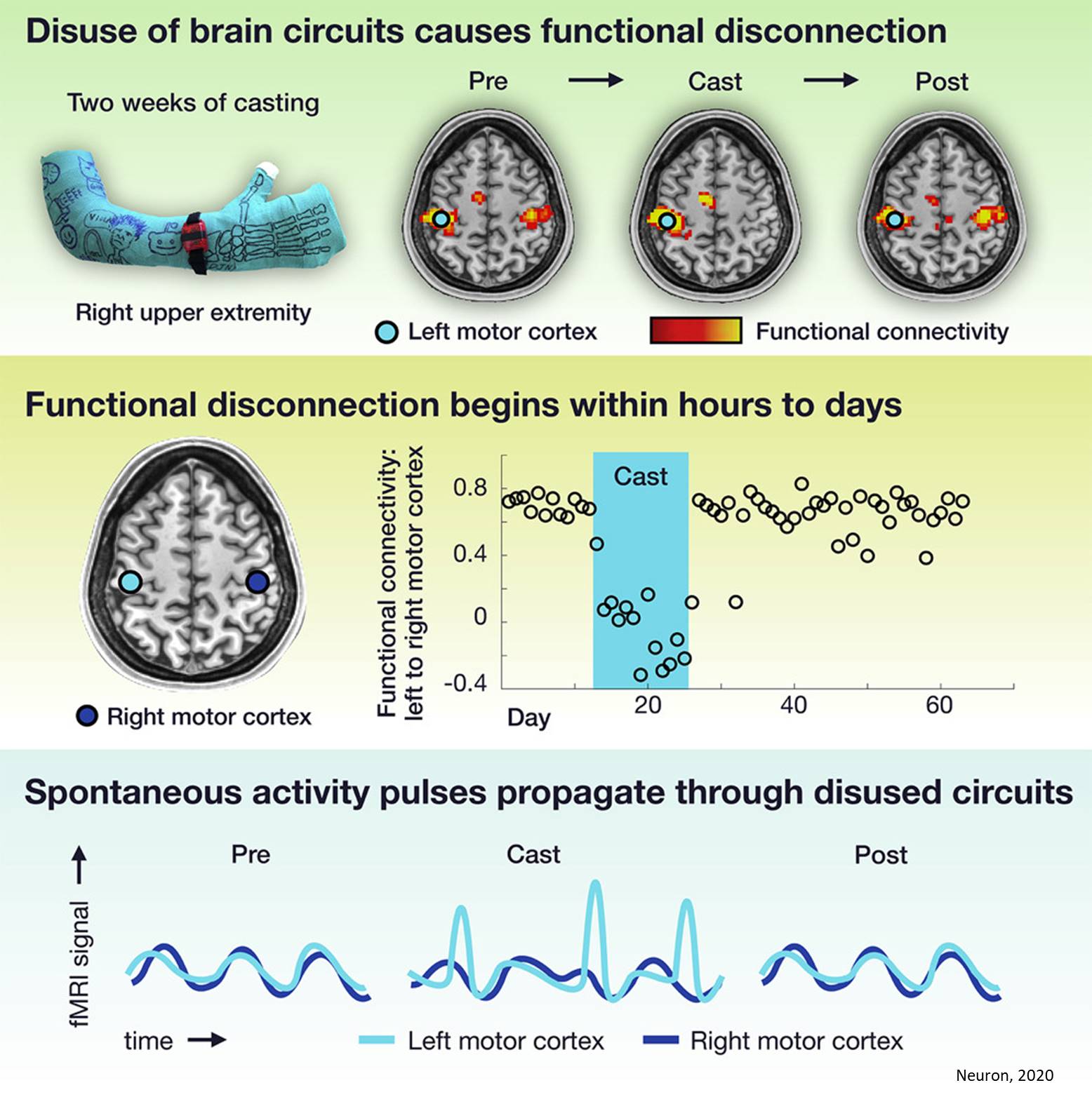 Disused Human Brain Circuits Show Plasticity and Spontaneous Activity Pulses &nbsp;