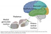 Abnormalities in the thalamus linked to schizophrenia